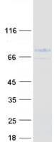 Human MID1 Protein (Recombinant Myc-DDK (Flag))