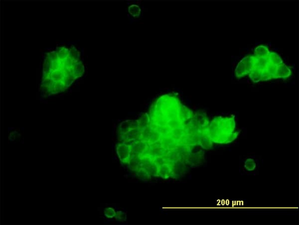 IHC-plus™ STX5 / Syntaxin 5 Antibody (clone 5A6)