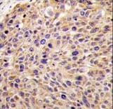 GGPS1 Antibody (aa16-46)