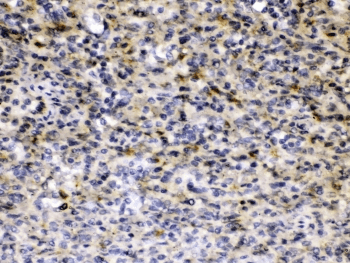 HBV / Hepatitis B Virus Antibody