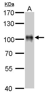 IHC-plus™ VIL1 / Villin Antibody (aa7-246)
