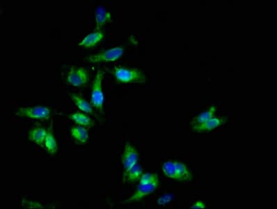 EPOR / EPO Receptor Antibody (aa320-506)