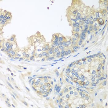 CUL3 / Cullin 3 Antibody
