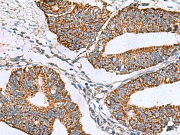 SLMO2 Antibody