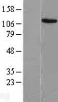 Human MECOM / EVI1 Protein (Over-Expression Lysate Myc-DDK (Flag))