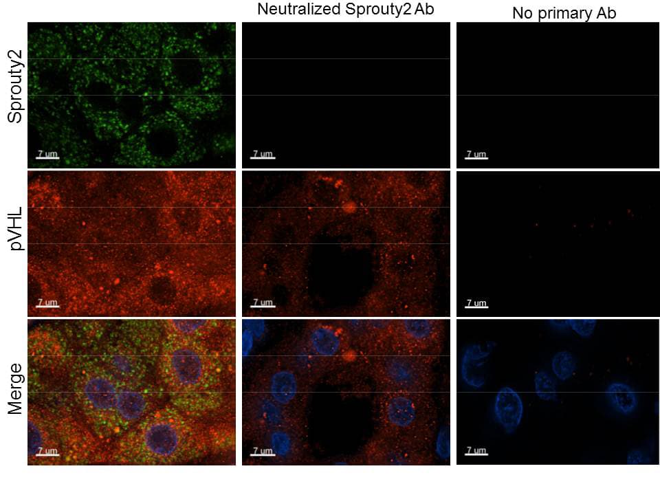 SPRY2 / Sprouty 2 Antibody (Internal)