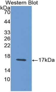 IFN Gamma / Interferon Gamma Antibody (aa23-156)