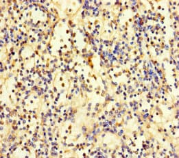 Polyclonal Rabbit anti-Human ZNF221 Antibody