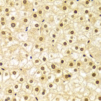 LMNA / Lamin A+C Antibody