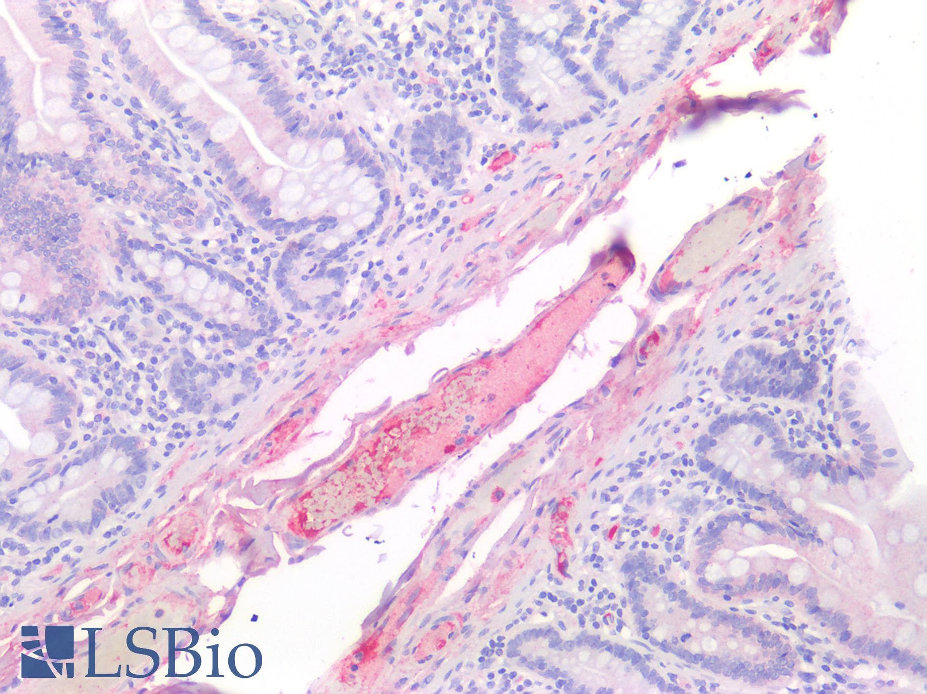 IHC-plus™ Polyclonal Rabbit anti-Human FAP Alpha Antibody (Extracellular Domain, IHC)
