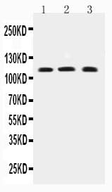 Polyclonal Rabbit anti-Human TRPC4 Antibody (aa961-977, WB)