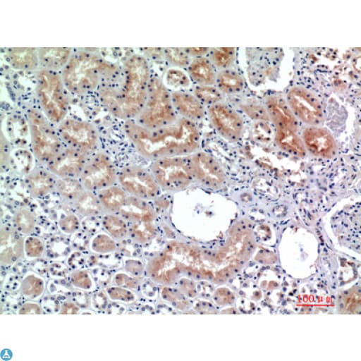 DPP4 / CD26 Antibody