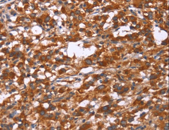 Polyclonal Rabbit anti-Human Gephyrin Antibody (IHC)