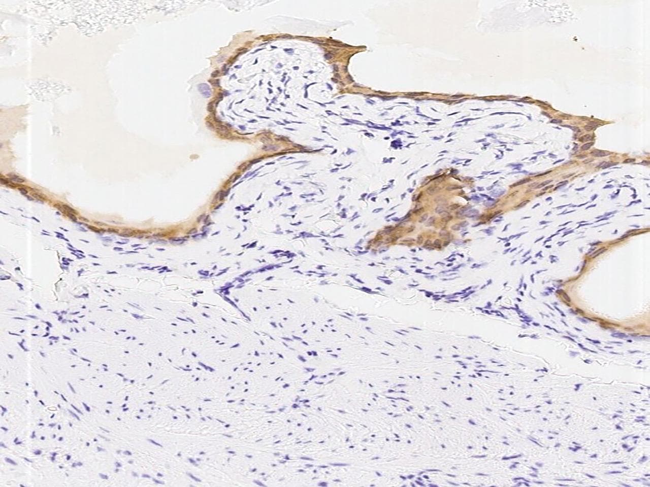 KRT14 / CK14 / Cytokeratin 14 Antibody (Preservative Free)