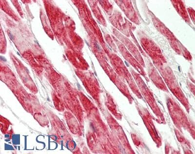 DES / Desmin Antibody (aa104-391, clone 4G1, Carrier-free)