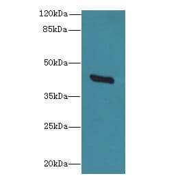 GDAP1L1 Antibody