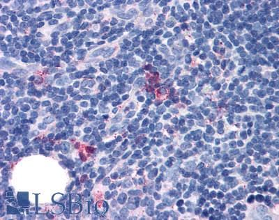 PathPlus™ ADGRG3 / GPR97 Antibody (Extracellular Domain)