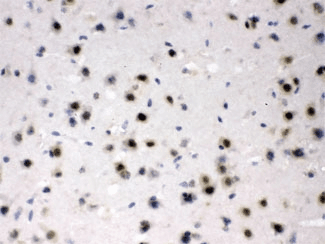 AZIN2 / Antizyme Inhibitor 2 Antibody