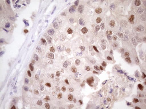 ZNF200 Antibody (clone OTI5F4)