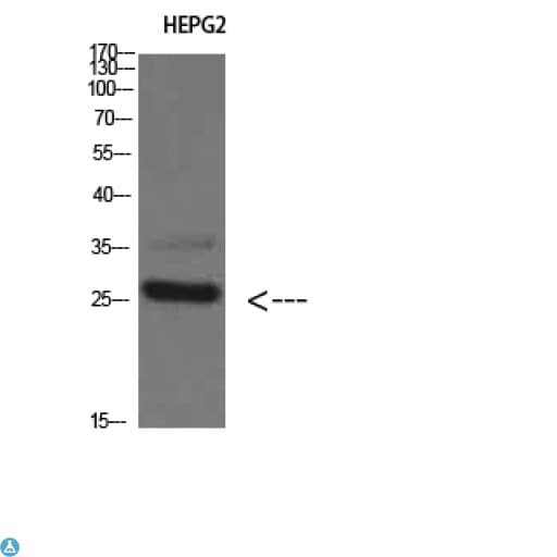 TPSD1 / Tryptase Delta 1 Antibody