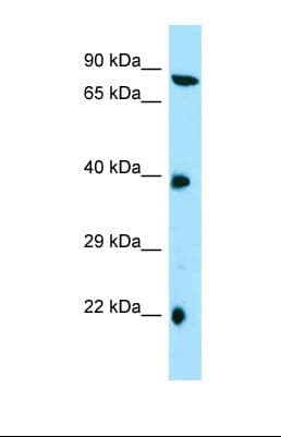Polyclonal Rabbit anti-Human TTC4 Antibody (aa201-250, WB)