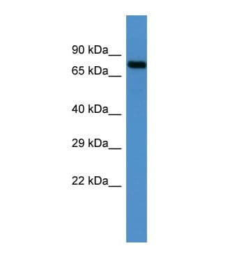 Polyclonal Rabbit anti-Human TRIM1 / MID2 Antibody (aa455-504, WB)