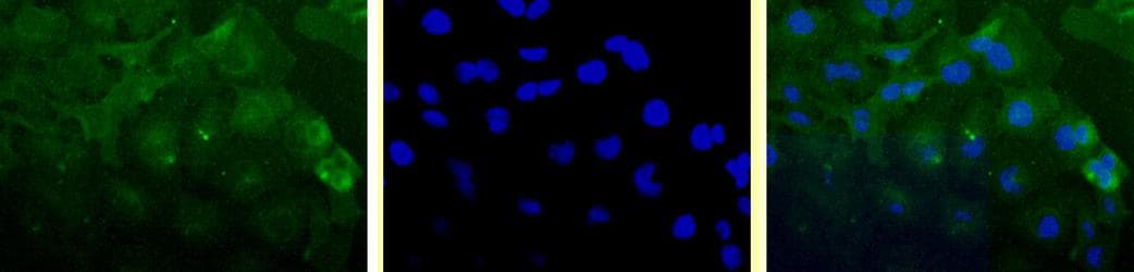 BIRC5 / Survivin Antibody (aa57-67, clone 60.11, DY488)