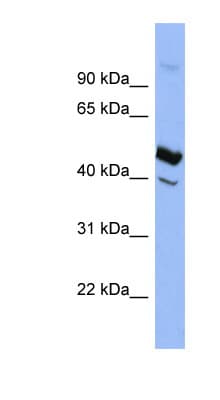 SERPIND1 / Heparin Cofactor 2 Antibody (aa323-372)