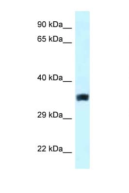 Polyclonal Rabbit anti-Human SLC25A33 Antibody (aa146-195, WB)