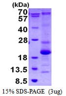Human ASF1B Protein (Recombinant His)