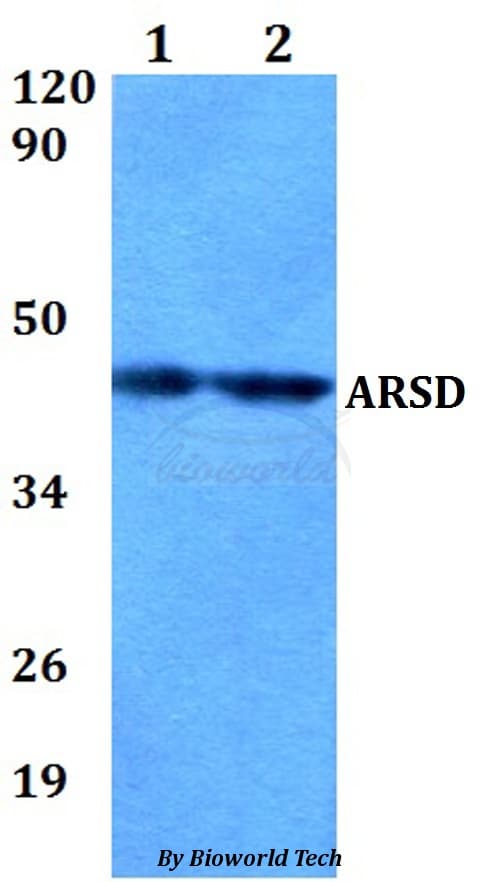 Polyclonal Rabbit anti-Human ARSD / Arylsulfatase D Antibody (WB)