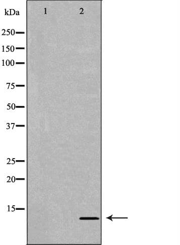 Polyclonal Rabbit anti-Human MIF Antibody (IHC, WB)