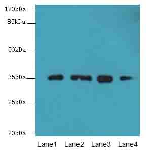 FAHD2A Antibody