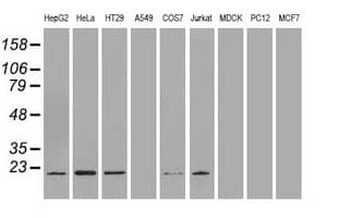 AK1 / Adenylate Kinase 1 Antibody (clone OTI19D1)