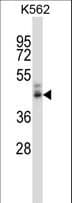 NPY4R / PPYR1 Antibody (aa1-30)