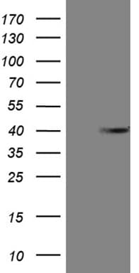 ANP32C Antibody (clone OTI10A10)