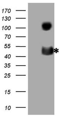 CD40 Antibody (aa21-166, clone OTI8G5, Carrier-free)