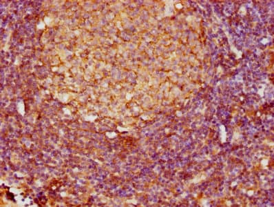 FCER2 / CD23 Antibody (aa48-321)