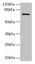 Polyclonal Rabbit anti-Human SLC6A6 / Taurine Transporter Antibody (IHC, WB)