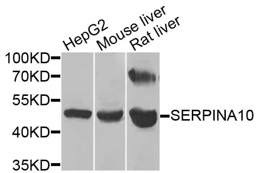 SERPINA10 / PZI Antibody