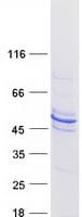 Human ACTR1B Protein (Recombinant Myc-DDK (Flag))