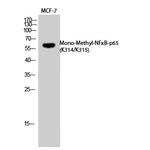 RELA / NFKB p65 Antibody (mono-methylation site of K314/K315)