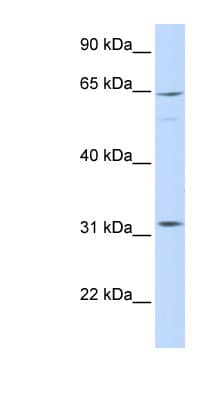 Polyclonal Rabbit anti-Human ARHGAP25 Antibody (aa504-553, WB)