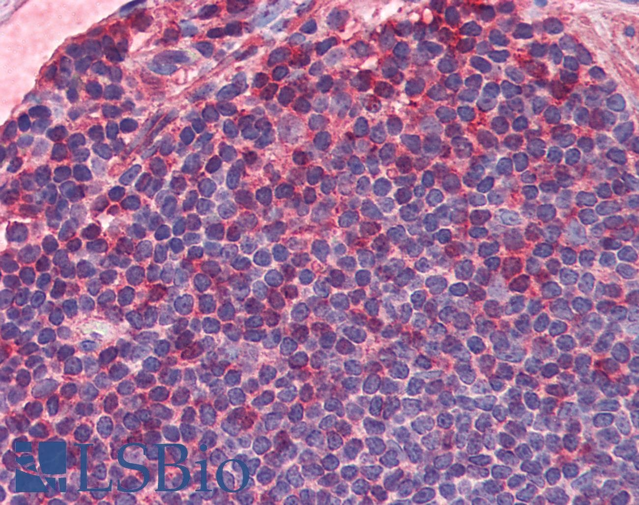 IHC-plus™ Polyclonal Rabbit anti-Human IL7R / CD127 Antibody (IHC, WB)