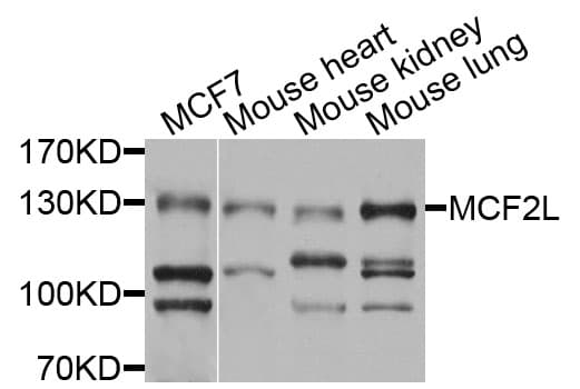 Polyclonal Rabbit anti-Human MCF2L / DBS Antibody (WB)
