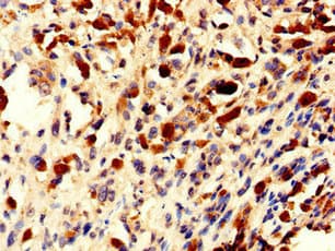 Polyclonal Rabbit anti-Human NOLA2 Antibody