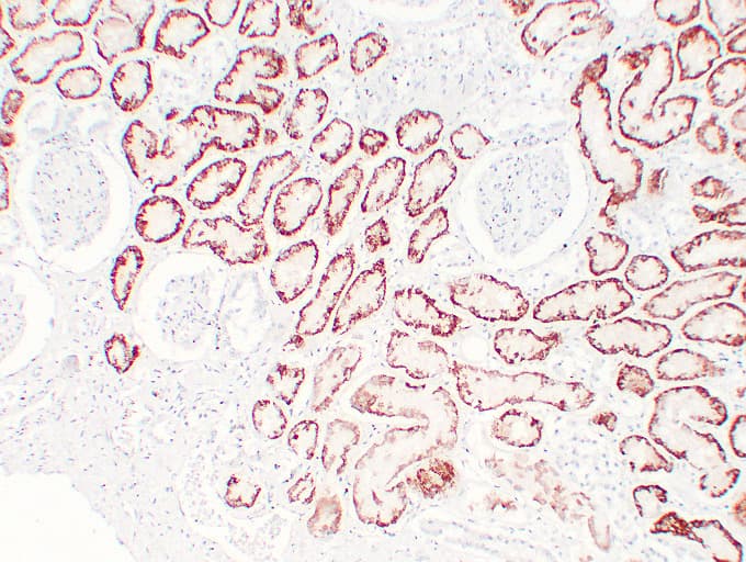 VHL / Von Hippel Lindau Antibody (clone ABT-PVHL)