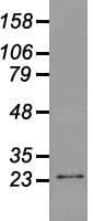 Monoclonal Mouse anti-Human NEUROG1 / NGN1 / Neurogenin 1 Antibody (clone OTI8G8, IF, WB)
