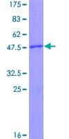 Human RHOB Protein (Recombinant GST)