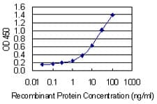 Monoclonal Mouse anti-Human PLS3 / T Plastin Antibody (clone 5B9, IF, WB)